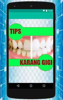Play atasi karang gigi alami