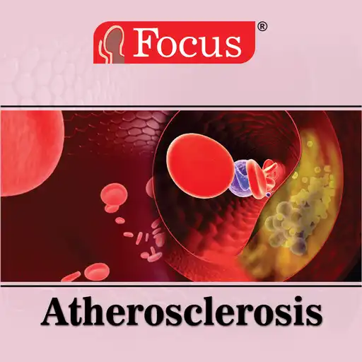 Play Atherosclerosis APK