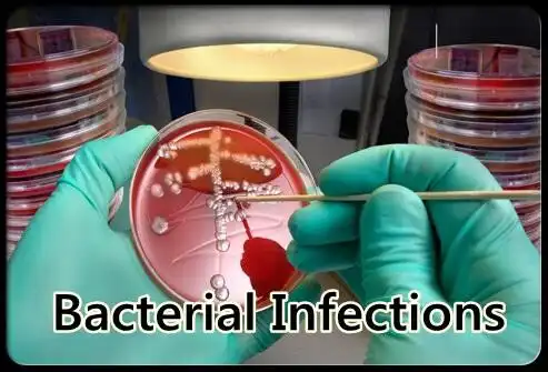 Play Bacterial Infections as an online game online Bacterial Infections with UptoPlay Play Bacterial Infections as an online game Bacterial Infections with UptoPlay