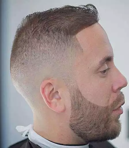 Play Balding Hairstyles
