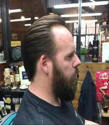 Play Balding Hairstyles