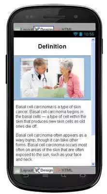 Play Basal Cell Carcinoma Disease
