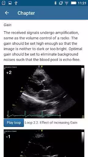 Play Basic - Transthoracic Echocardiography Play Basic - Transthoracic Echocardiography