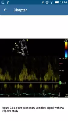 Play Basic - Transthoracic Echocardiography Play Basic - Transthoracic Echocardiography