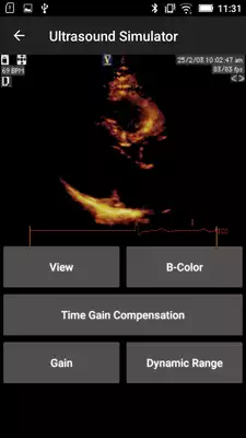 Play Basic - Transthoracic Echocardiography Play Basic - Transthoracic Echocardiography
