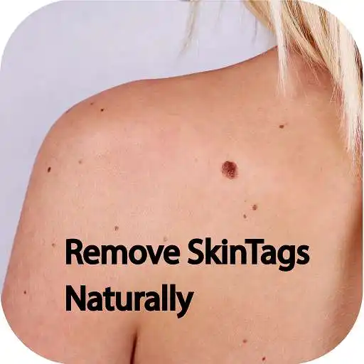Play Beauty Exercise - Remove SkinTags Naturally APK Play Beauty Exercise - Remove SkinTags Naturally APK