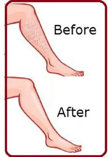 Play Beauty tips In Malayalam