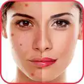 Free play online Blemishes APK