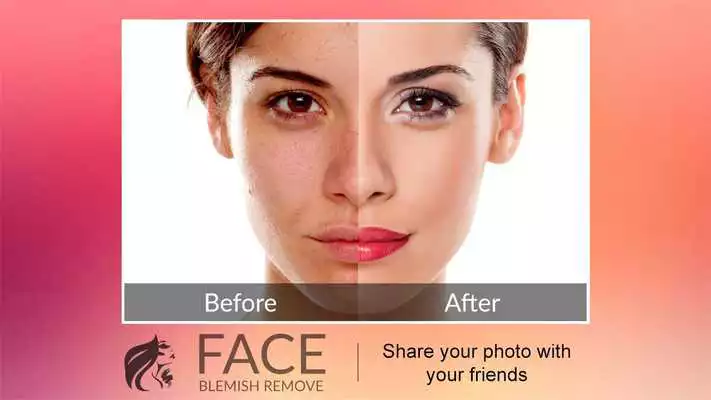Play Blemishes
