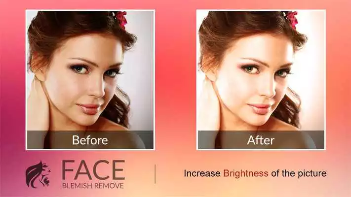 Play Blemishes