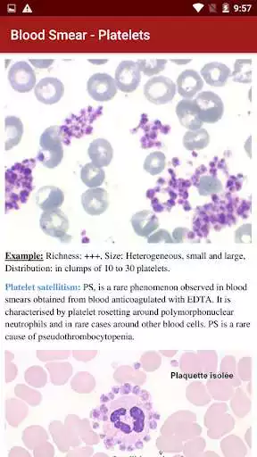 Play Blood Smear as an online game online Blood Smear with UptoPlay com.xdev.bloodsmear Play Blood Smear as an online game Blood Smear with UptoPlay