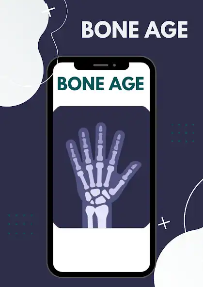 Play bone age - wrist  and enjoy bone age - wrist with UptoPlay