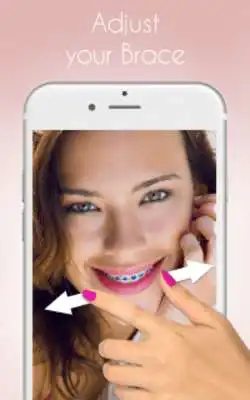 Play Braces 2018