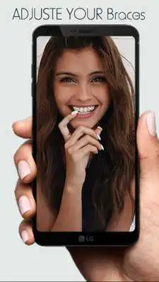 Play Braces 2018