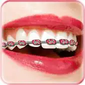 Free play online Braces Booth Editor APK Free play online Braces Booth Editor APK