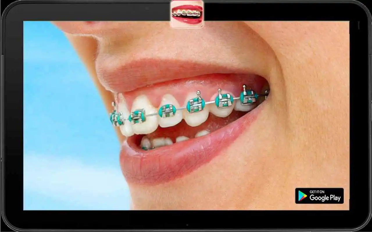 Play Braces Booth Editor