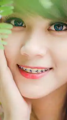 Play Braces Booth Photo Editor