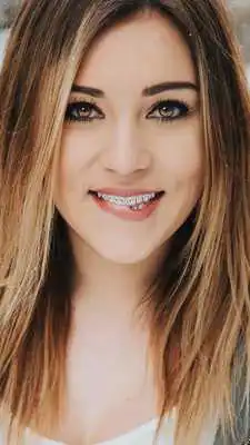 Play Braces Booth Photo Editor