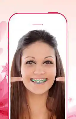Play Braces Booth Pro