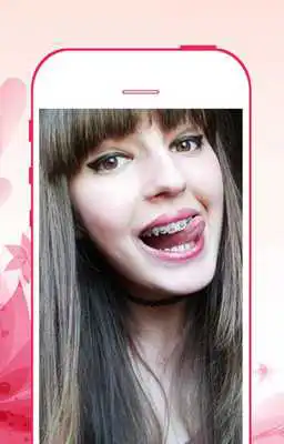 Play Braces Booth Pro