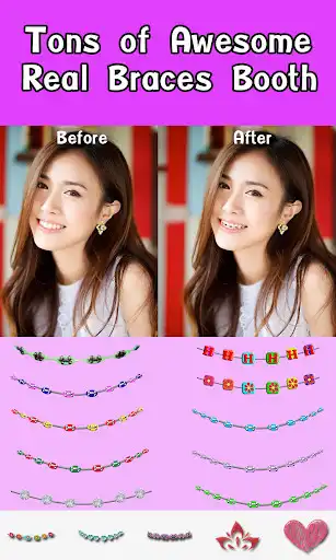 Play Braces Booth as an online game Braces Booth with UptoPlay