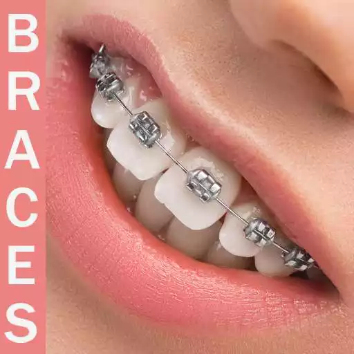 Play Braces Camera Editor APK Play Braces Camera Editor APK