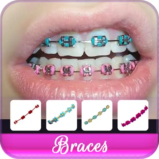 Play Braces Colors Beauty APK Play Braces Colors Beauty APK