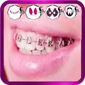 Free play online Braces Photo Collage APK Free play online Braces Photo Collage APK