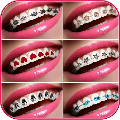 Play Braces Photo Editor APK
