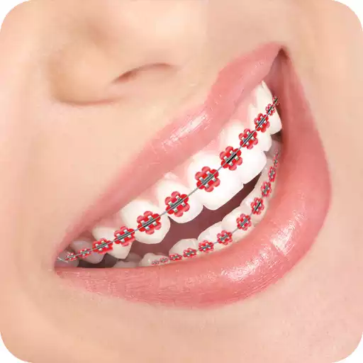 Free play online Braces Photo APK