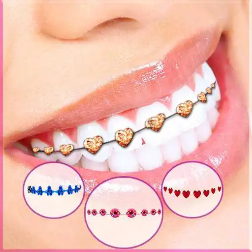Free play online Braces Teeth Camera APK