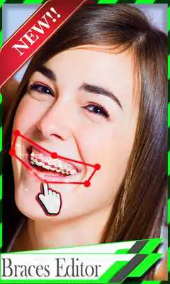 Play Braces Teeth Camera