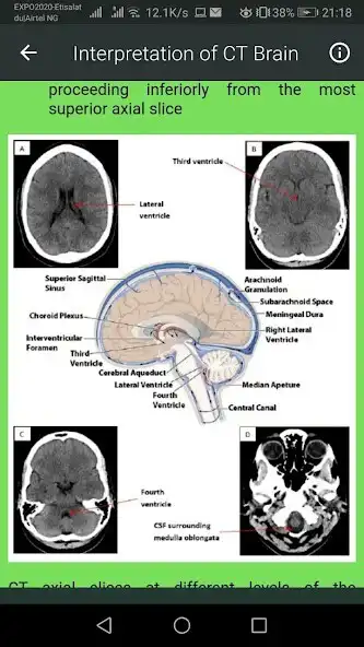 Play Brain CT Scan Interpretation  and enjoy Brain CT Scan Interpretation with UptoPlay