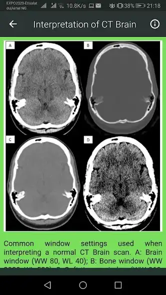 Play Brain CT Scan Interpretation as an online game Brain CT Scan Interpretation with UptoPlay