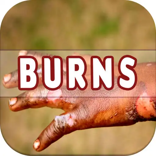 Play Burns: Causes, Diagnosis, and Management APK Play Burns: Causes, Diagnosis, and Management APK