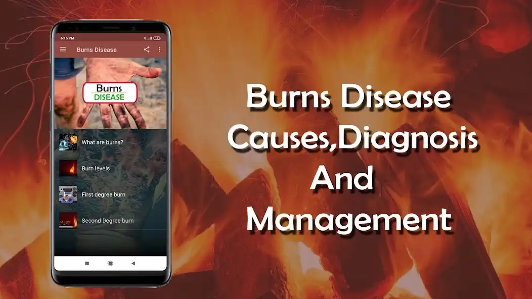 Play Burns Disease -  Causes, Diagn  and enjoy Burns Disease -  Causes, Diagn with UptoPlay
