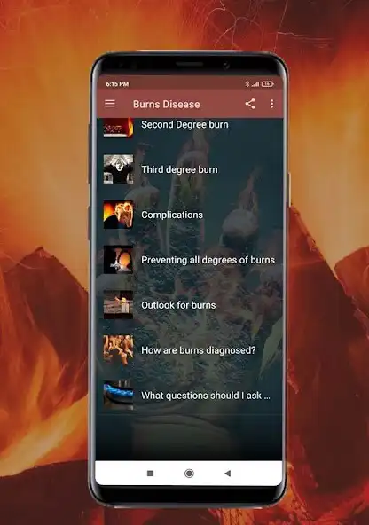 Play Burns Disease -  Causes, Diagn as an online game Burns Disease -  Causes, Diagn with UptoPlay