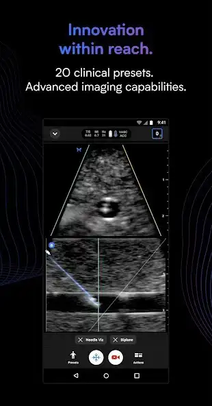 Play Butterfly iQ — Ultrasound as an online game Butterfly iQ — Ultrasound with UptoPlay