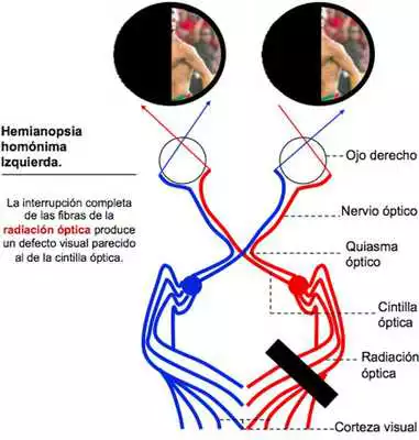 Play Campimetria