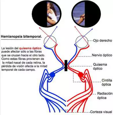Play Campimetria
