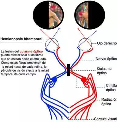 Play Campimetria