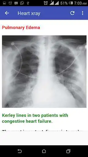 Play APK Cardiac X-rays  and enjoy Cardiac X-rays with UptoPlay com.andromo.dev677517.app711282