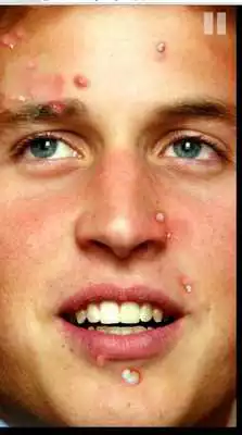 Play Celebrity Breakout