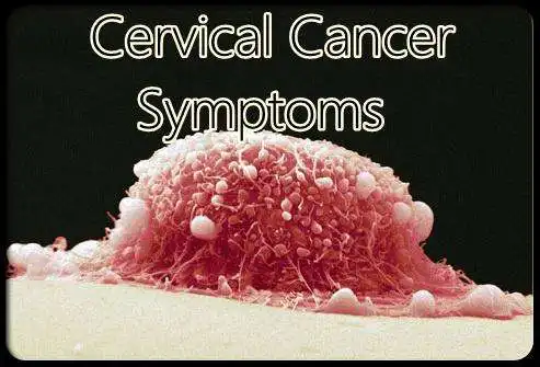 Play Cervical Cancer Symptoms