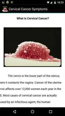 Play Cervical Cancer Symptoms
