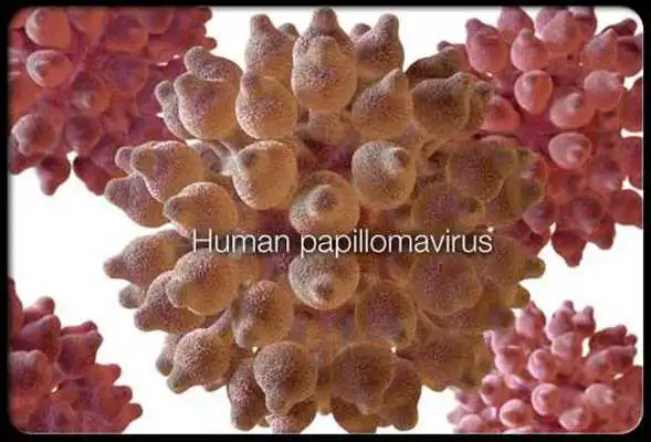 Play Cervical Cancer Symptoms