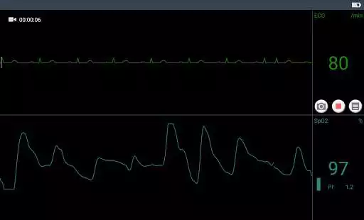 Play Check Trace Play Check Trace