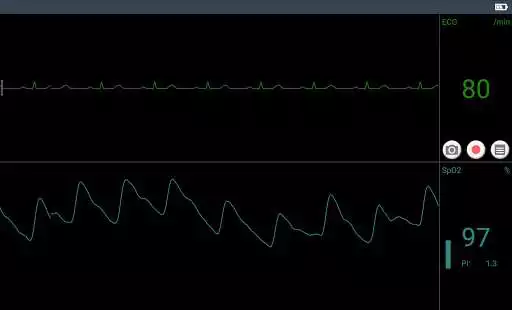 Play Check Trace Play Check Trace
