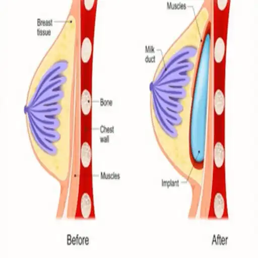 Play chest lifting exercises APK