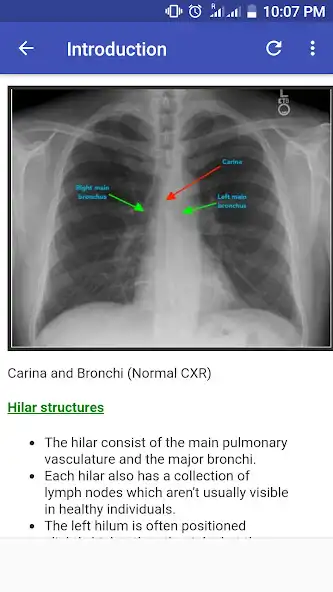Play Chest X-Ray Based Cases  and enjoy Chest X-Ray Based Cases with UptoPlay